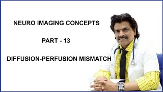 NEURO IMAGING CONCEPTS PART  13 DIFFUSION PERFUSION MISMATCH [upl. by Geilich]