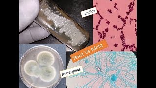 Study of fungi  Yeast and mold [upl. by Neyud]