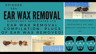 EAR WAX REMOVAL COMPILATION PLUGS OF EAR WAX REMOVED EP364 [upl. by Frodine616]