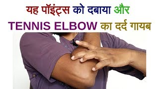 Acupressure Points For Tennis Elbow PainTENNIS ELBOW PAIN Relief In 2 Minutes at home [upl. by Feodora]