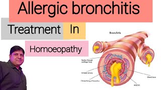 Homeopathic medicine for Allergic Bronchitis  Allergic Bronchitis Treatment in Homeopathy  Hindi [upl. by Benedetto]