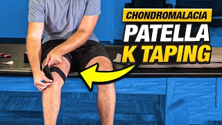 Relieve Knee Pain FAST Chondromalacia Patella K Taping [upl. by Richmound495]