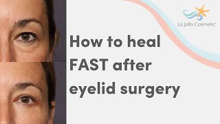 How to heal FAST after eyelid surgery [upl. by Yliak358]