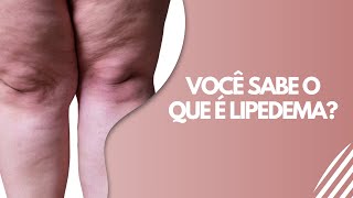 Você sabe o que é lipedema [upl. by Kapor]