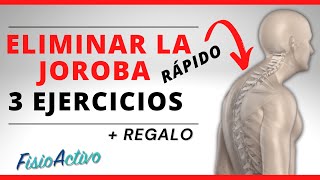 Cómo ELIMINAR la JOROBA de la Espalda 🐫 3 EJERCICIOS FÁCILES   REGALO 🎁 [upl. by Ydarg]