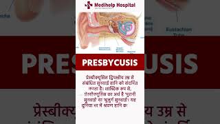 What is PRESBYCUSIS eardisease [upl. by Cinelli]