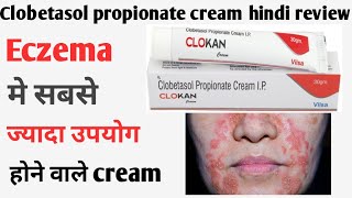 Clobetasol propionate cream ip  Clobetasol propionate cream ip uses in hindi  clokan cream hindi [upl. by Amara913]