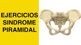 Sindrome Piramidal  Piriforme  Estiramiento Piramidal y Pinzamiento del Nervio Ciatico  Ciatica [upl. by Ydac]