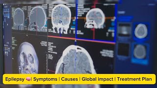 Epilepsy Explained Types Symptoms Causes amp Treatment [upl. by Acnaiv]