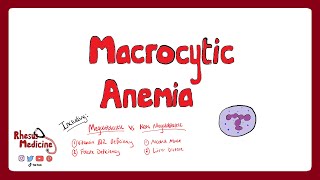 MACROCYTIC ANEMIA  Megaloblastic Anemia Vitamin B12 and Folate Deficiency  Rhesus Medicine [upl. by Strephon]