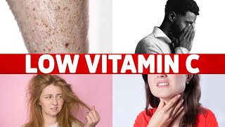 8 Signs of a Vitamin C Deficiency Youve Never Heard About [upl. by Aivyls]