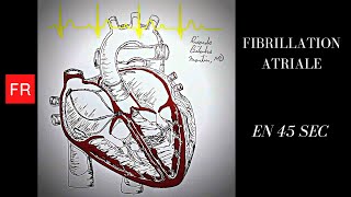 Arythmies animation cardiaque et ECG  Fibrillation Atriale Shorts [upl. by Rickie72]