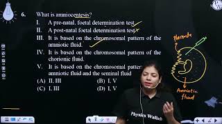 What is amniocentesis Iampnbsp ampnbsp A prenatal foetal determination test IIampnbsp ampnbspA [upl. by Killigrew]