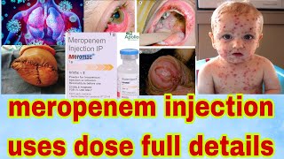 meropenem injection ip 1gm in hindi  meropenem injection uses in hindi Gyanear [upl. by Eiblehs]