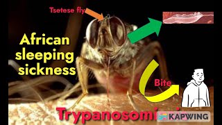 Trypanosomiasis I African sleeping sickness I Trypanosoma brucei gambiense amp rhodesiense I [upl. by Anawk]