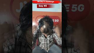 Day 5 use minoxidil morr f5 result  adivasi hair oil results haircare adivasihairoil minoxidil [upl. by Cyrus786]