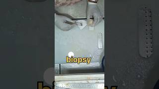 Biopsy samplesurgicalpathology biology biopsy histopathology anatomy pathology [upl. by Barker889]