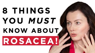 Rosacea  The 8 Things Everyone Needs To Know  Rosacea Awareness Month  Dr Sam Bunting [upl. by Os]