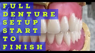 Full Denture Setup From Start To Finish [upl. by Notnerb707]