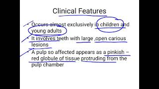 chronic hyperplastic pulpitis [upl. by Eniagrom]