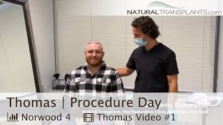 Hair Restoration Procedure Day for 26YearOld with Norwood 4 Hair Loss  Dr Blumenthal Thomas [upl. by Shalom]