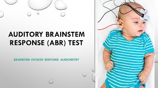 Auditory Brainstem Response ABR Test  Brainstem evoked response audiometry LABAT ABR [upl. by Drareg]