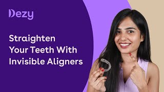 Straighten Your Teeth With Invisible Aligners  Clear Braces  Kannada [upl. by Enelra]