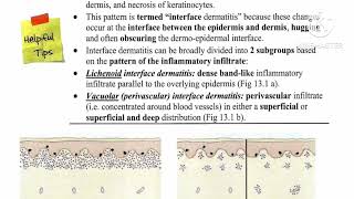 1 Lichenoid Review ✅ Lichen planus 🔸 Lichenoid drug eruption by Dr Ahmed Kamel [upl. by Cosimo862]