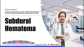 Subdural Hematoma  Causes Diagnosis Symptoms Treatment Prognosis [upl. by Aneloc107]