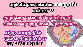 what is cephalic position of fetus in tamil  symptoms of fetus cephalic position in tamil [upl. by Cardon]