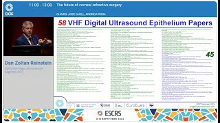 Reinstein  developer of epithelial mapping gives an overview of epithelial mapping applications [upl. by Granny]