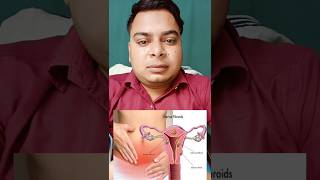 Treatment of fibroids in uterus at home fibroid trending [upl. by Simah141]