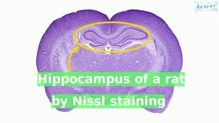 Nissl staining [upl. by Cello220]