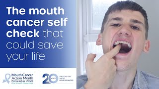 How to do a mouth cancer check at home [upl. by Ramar]