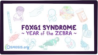 FOXG1 syndrome Year of the Zebra [upl. by Gent]