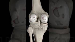 Knee joint 3d representation anatomy medicalimaging radiology medicaltest ctscan [upl. by Ahsatniuq465]