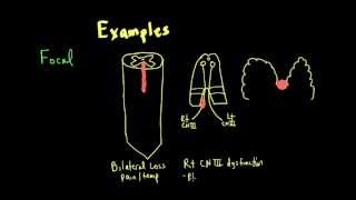 Schneid Guide to Neurological Lesion Localization [upl. by Firehs]