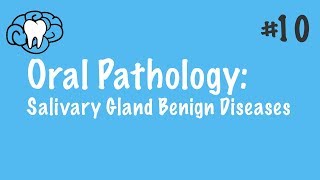 benign salivary gland tumors  oral pathology  عزت شومان [upl. by Akirderf]