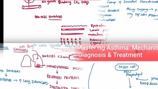 Chronic obstructive pulmonary disease  Chronic Bronchitis Emphysema Asthma Bronchiectasis [upl. by Yemarej]