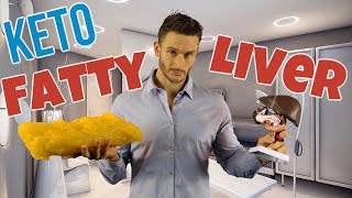 Does Keto Heal a Fatty Liver  Everything You Should Know [upl. by Elizabet]