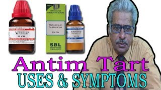 Anitim Tart  Uses amp Symptoms in Homeopathy by Dr PS Tiwari [upl. by Swee697]