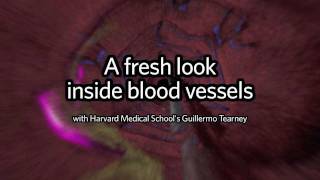 A fresh look inside blood vessels [upl. by Alden514]