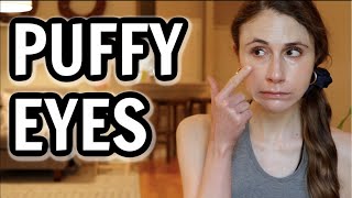 How to get rid of puffy eyes Dr Dray [upl. by Ycak]