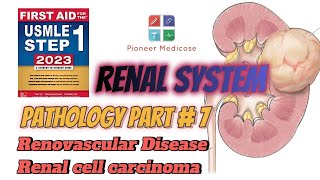 Renal Cell Carcinoma and Renovascular Diseases for USMLE step 1patho Part7First Aid in UrduHindi [upl. by Bunni]