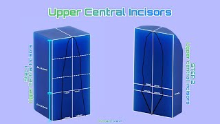 Step 1 Carving Upper Central Incisor Wax amp white board [upl. by Adrell]