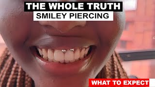 Smiley Piercing  WHAT TO EXPECT  PROCESS [upl. by Duarte]