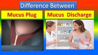 Difference Between vaginal Mucus Plug and vaginal Discharge [upl. by Duwalt257]