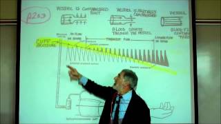 CARDIAC PHYSIOLOGY PART 4 by Professor Finkwmv [upl. by Neufer]