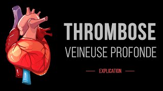 Thrombose Veineuse Profonde  Cardiologie  Détails [upl. by Reiche]