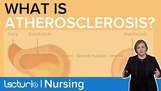 Pathophysiology of Atherosclerosis How does the Plaque Form  Pathophysiology  Lecturio Nursing [upl. by Mandy]